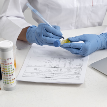 Intelligenza Artificiale per perfezionare l’interpretazione dei Drug Test